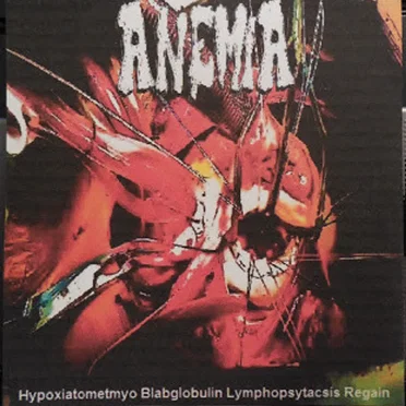 Hypoxiatometmyo Blabglobulin Lymphopsytacsis Regain