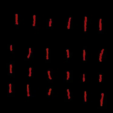 Strokes of Incarceration