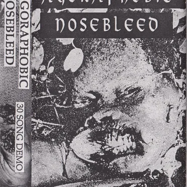 Agoraphobic Nosebleed