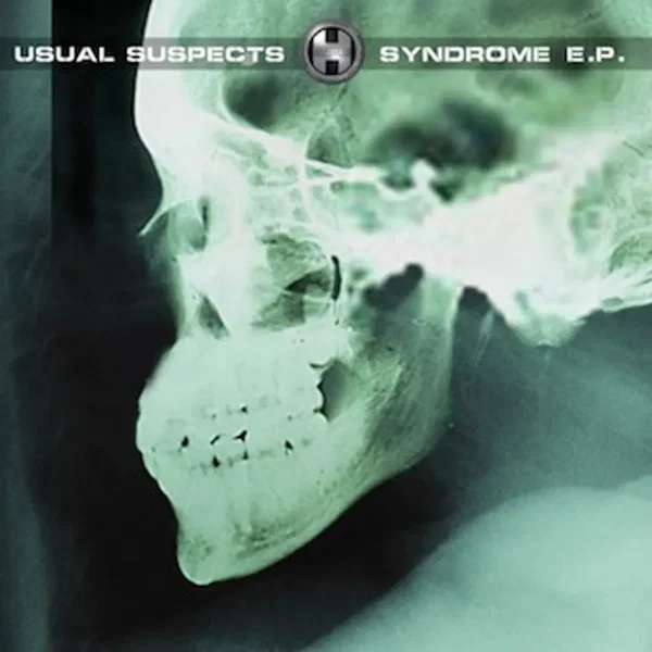 Syndrome E.P.
