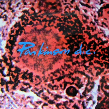 Overdream by Parkinson DC - album cover