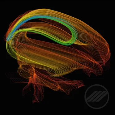 This Is Your Brain On Love (Instrumental)