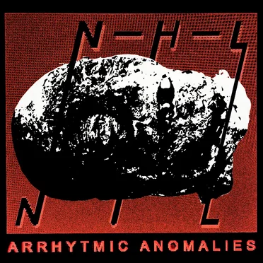 Arrhytmic Anomalies