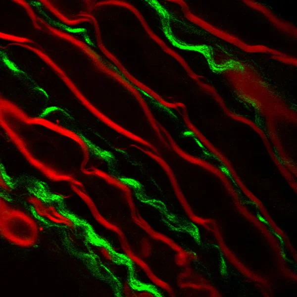 myelination 2