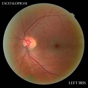 Escitalopram