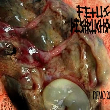 Demo 2018 by Fetus Destruction - album cover