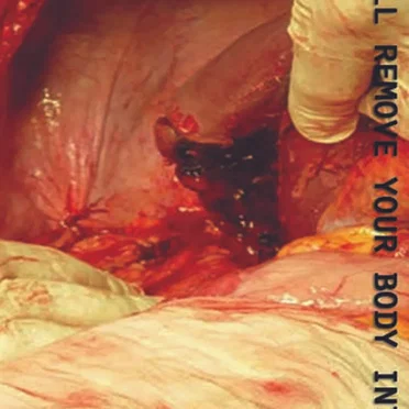 We Will Remove Your Body Interior