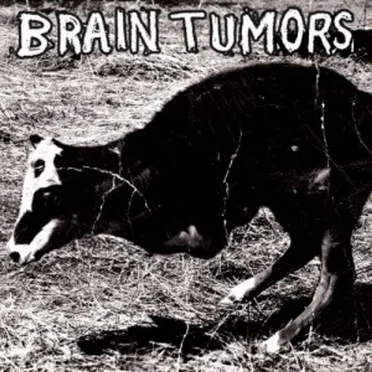 Brain Tumors