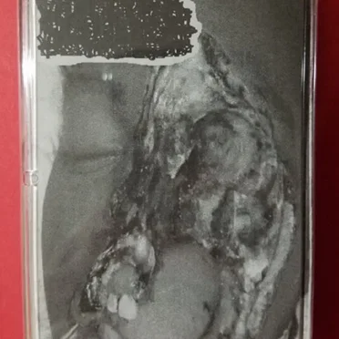 Cadaversludge / Stomachfuck