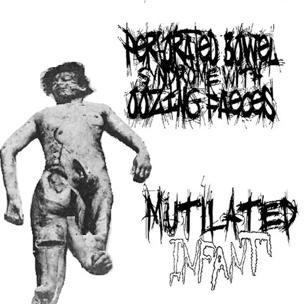 Perforated Bowel Syndrome With Oozing Faeces / Mutilated Infant