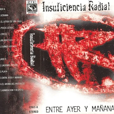 Insuficiencia Radial