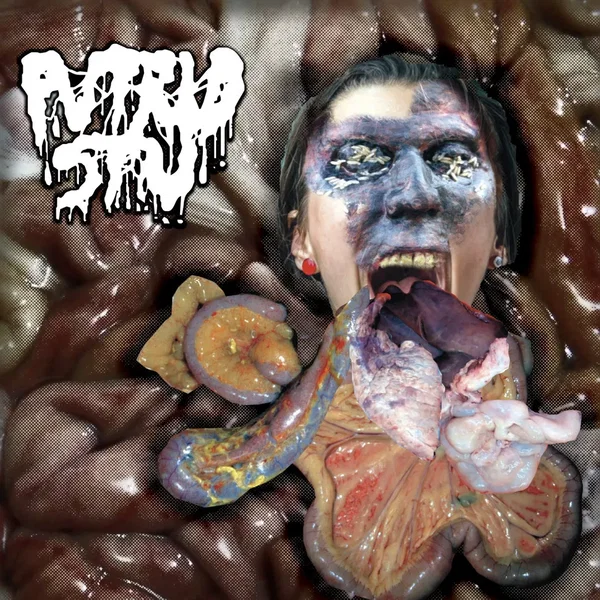 Amidst an Anal-Analgesic Assembly