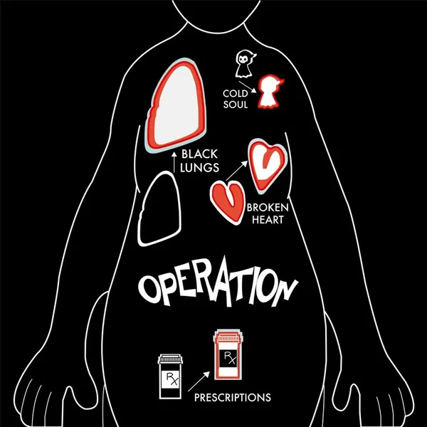 Operation