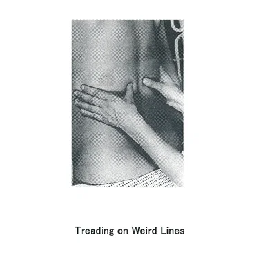 Treading on Weird Lines
