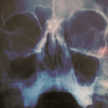 60 by 58918012 - album cover