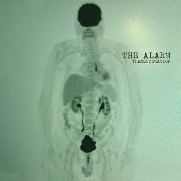 The Alarm
