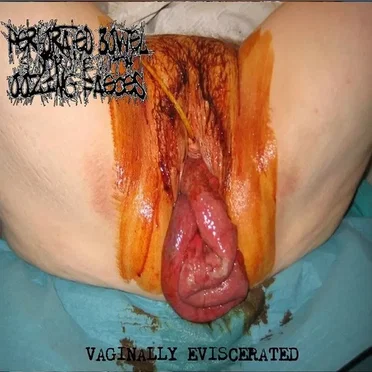 Vaginally Eviscerated