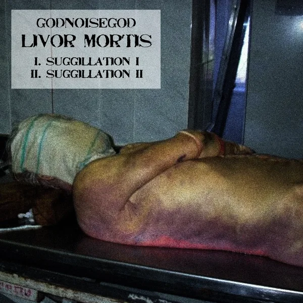 Livor Mortis