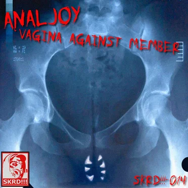 Analjoy