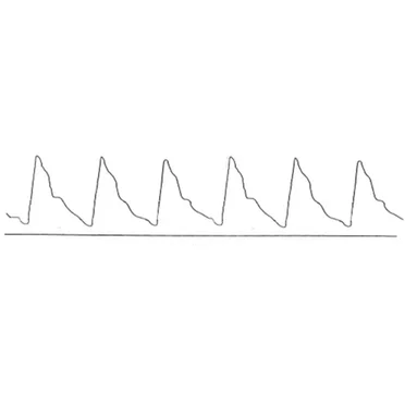 Check My Pulse