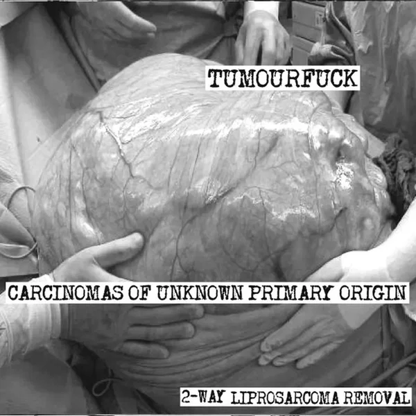 2-way Liprosarcoma Removal