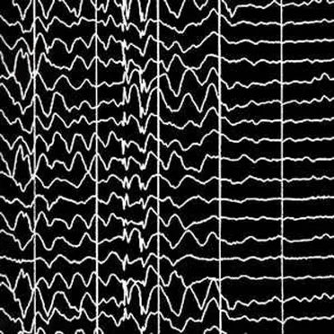 Seizure No. 5 by DJ Matuss - album cover