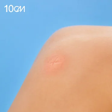 방에 모기가 있어 (4.4)