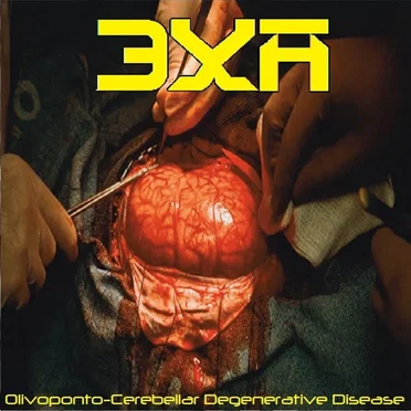 Olivoponto-Cerebellar Degenerative Disease