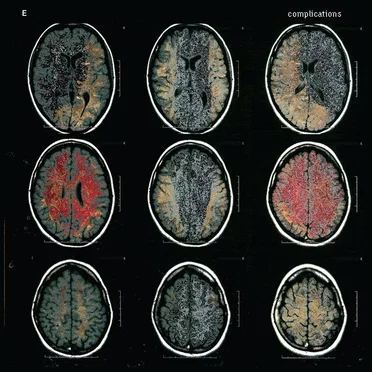 Complications by E - album cover