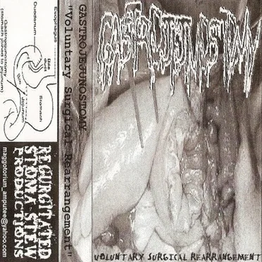 Voluntary Surgical Rearrangement by Gastrojejunostomy - album cover