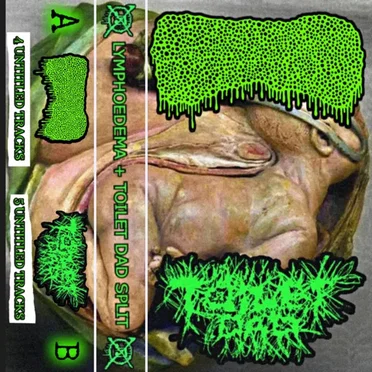 Lymphoedema / Toilet Dad by Lymphoedema - album cover