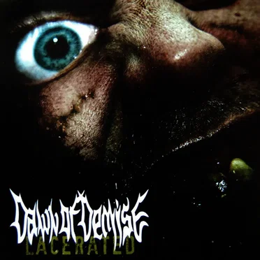 Lacerated by Dawn of Demise - album cover
