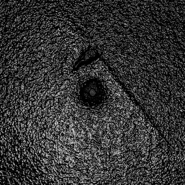 外傷を負った T̷̢̮̺͚̥̳̰̪̭͙̼͚̞͆͜Ṛ̷̨̦̩͉̺̼̥̩̰̣͍̪̰̬̃Ą̷̢̜̩̹̟̬̜̾̒̎̂͆̈́͒͋́Ù̴͓͍͕̰̦͜M̷̩͙̻͍̏̇A̵̧̙̍