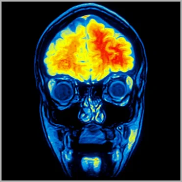 Tranceportation Remixes