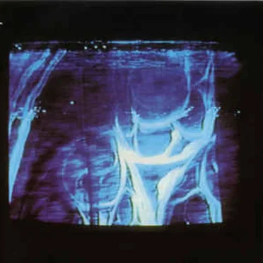 Documentation 1987-1992 by P. Children - album cover