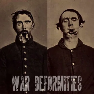 War Deformities