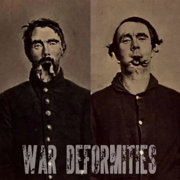 War Deformities