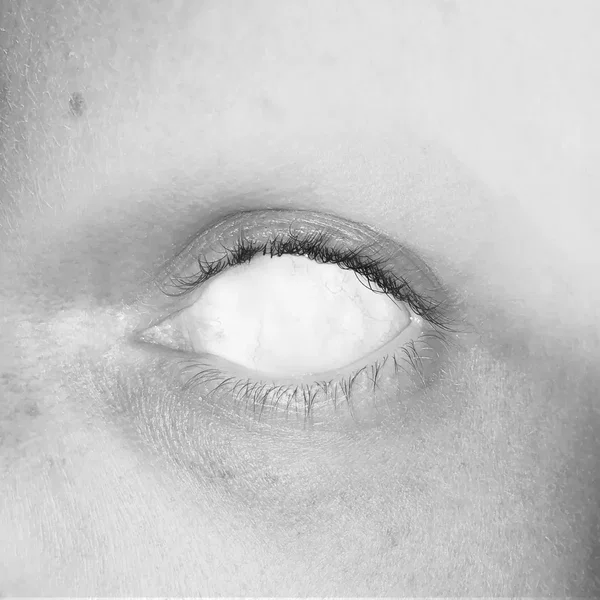Hasse mini Auge