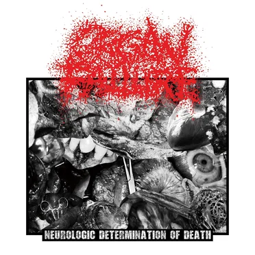 Organ Failure