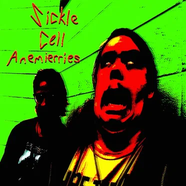 Sickle Cell Anemierries EP