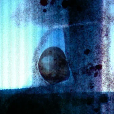Refrattario
