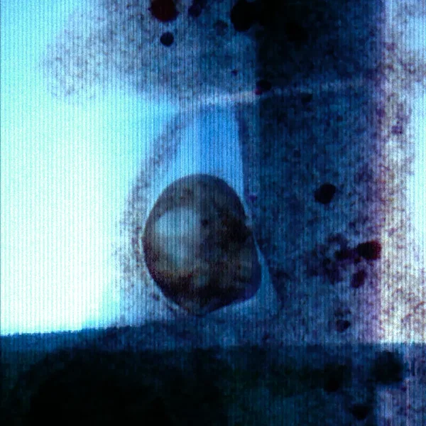 Refrattario