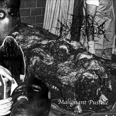 Malignant Pustule - Demo 2025 by Pus Excretor - album cover
