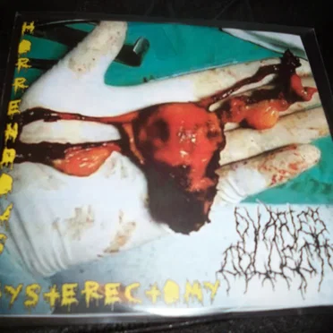 Horrendous Hysterectomy