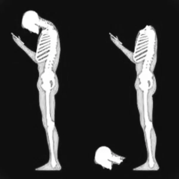 Shape