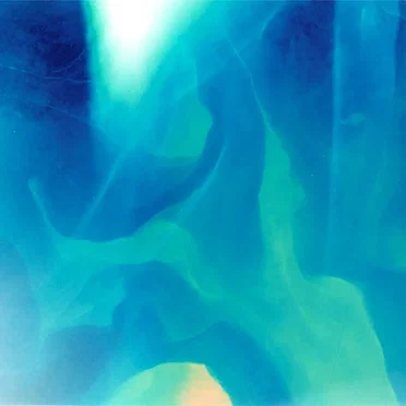 ウェザーリポート