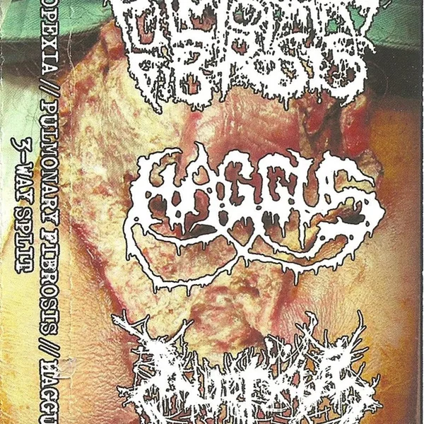 Haggus / Inopexia / Pulmonary Fibrosis