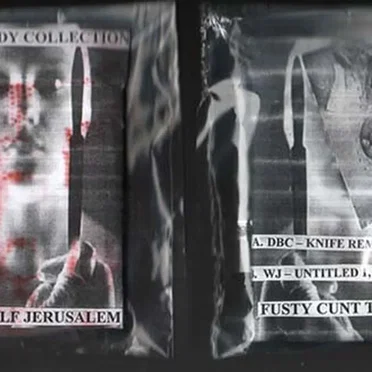 Knife Removed Smile / Untitled