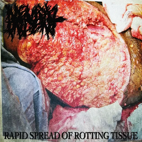 Rapid Spread of Rotting Tissue