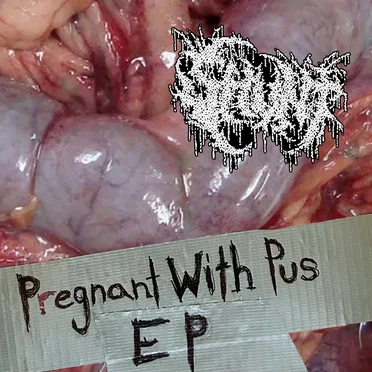 Pregnant With Pus by Shunt - album cover